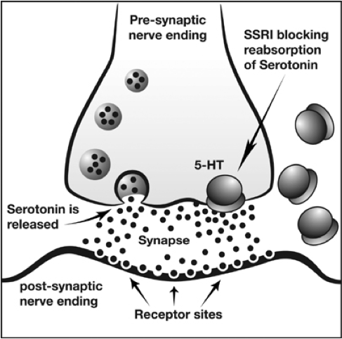 best ssri for anxiety and insomnia
